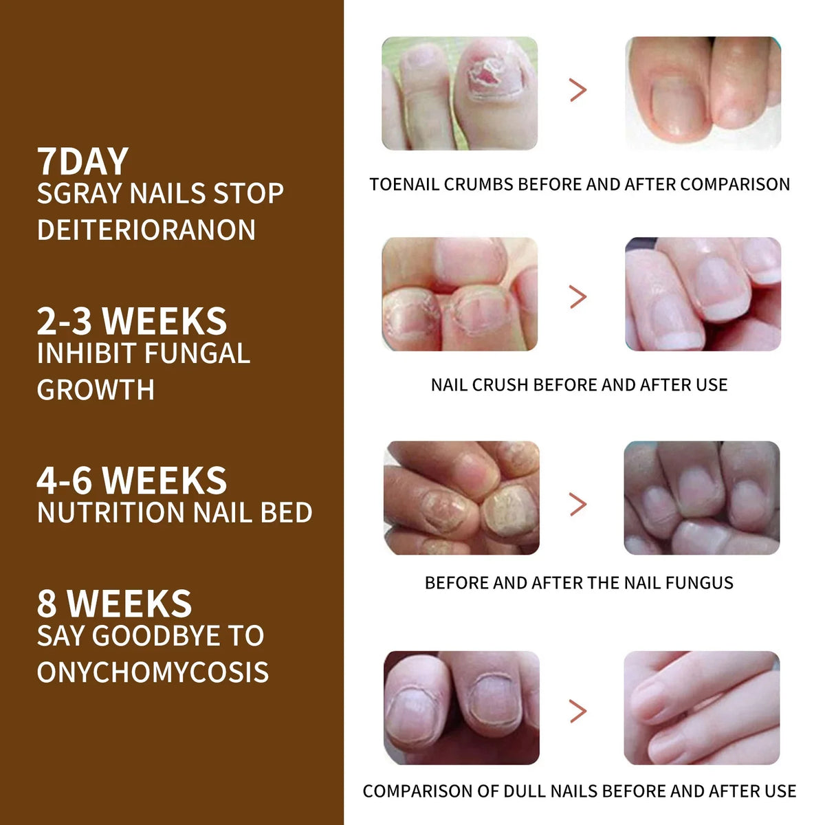 3PCS Nail Growth Deep Healing Organic Serum; Nail Growth Nail Serum; Reconstrux Nail Growth; Nail Growth and Strengthening Serum; Nail Serum for Growth and Repair for Damaged Nails